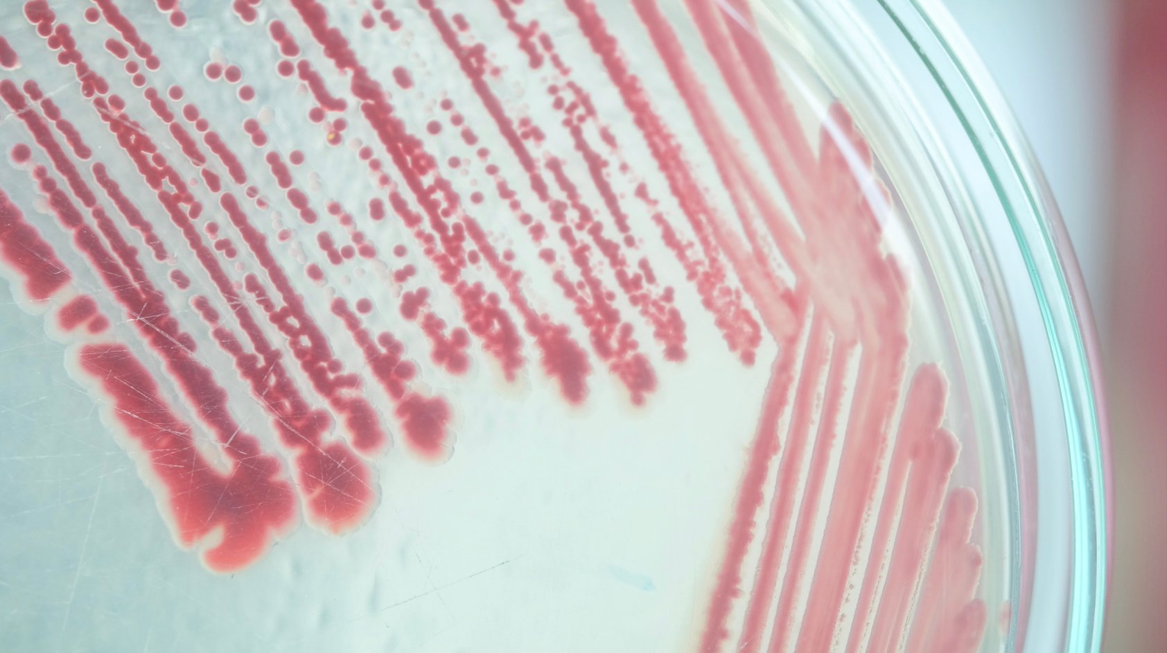 Pink mould, which is really a bacteria, growing on a petri dish.